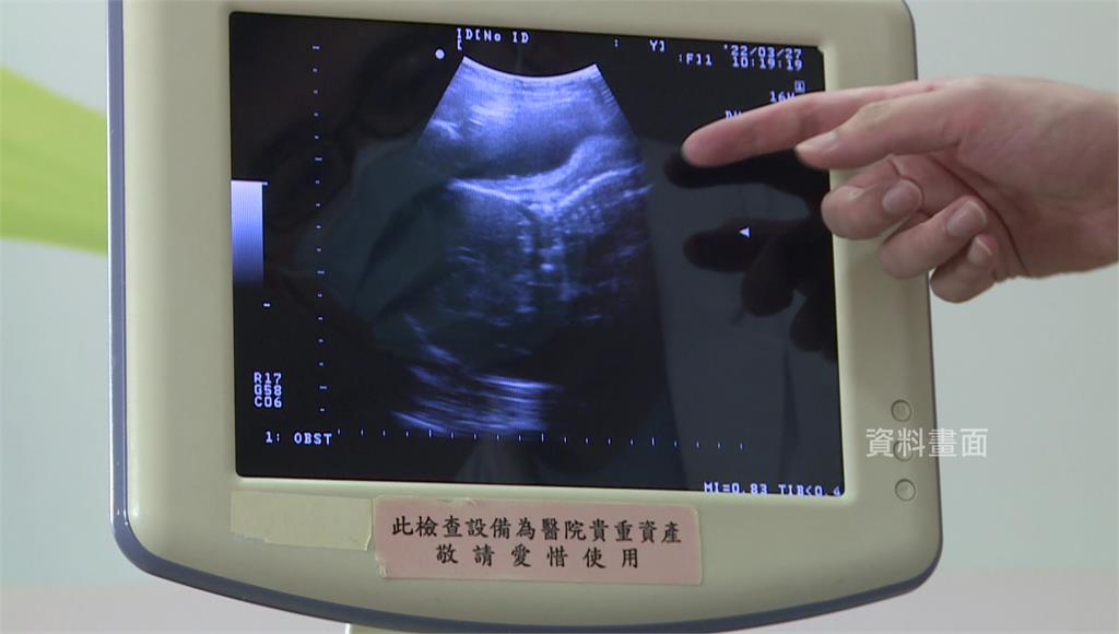 試管嬰兒受術婦女年齡升 醫籲放寬補助。圖／台視新聞